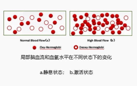 fNIRS研究表明：有/無自殺意念的抑郁癥個(gè)體在特定任務(wù)期間DLPFC激活不同